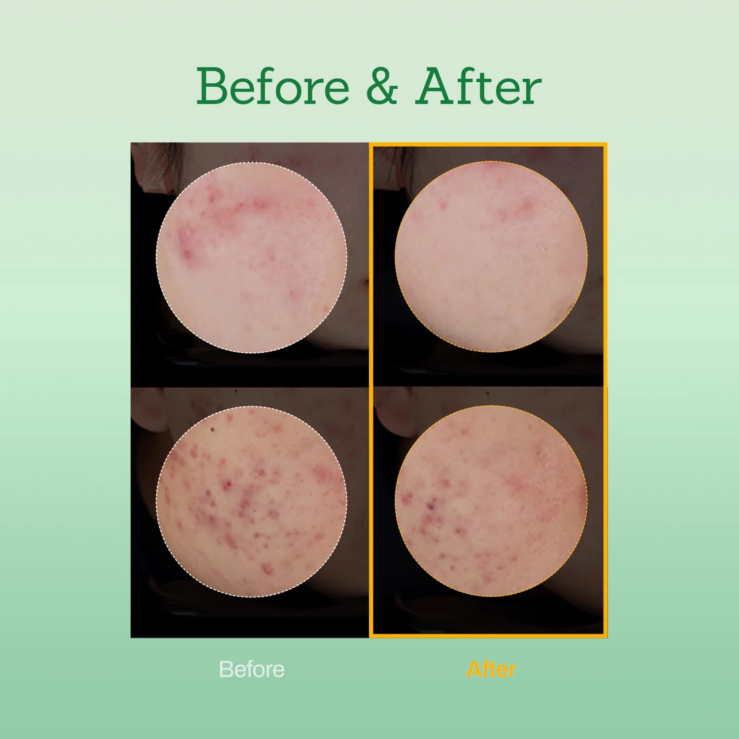 Mugwort Super Calming Toner + Serum - Image 7