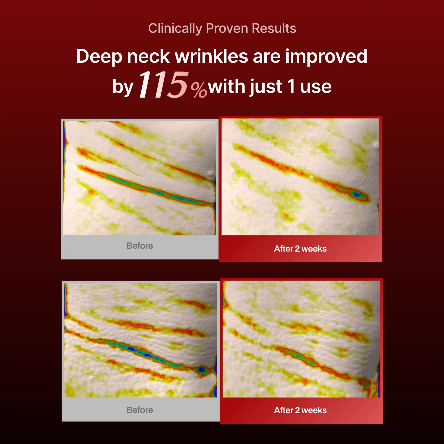 Facial Roller - Image 7